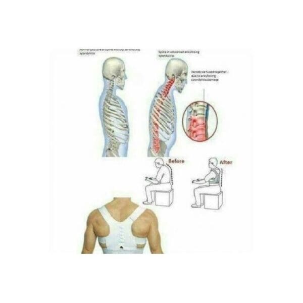 Support Correcteur De Posture - Blanc